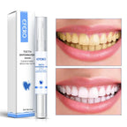 Teeth Whitening Pen Cleaning Serum Remove Plaque Stains Dental Tools Whiten Teeth Oral Hygiene Tooth Whitening Pen - Grab Online Now